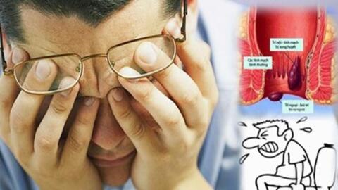 Không còn lo lắng bệnh trĩ với vị thuốc vườn nhà