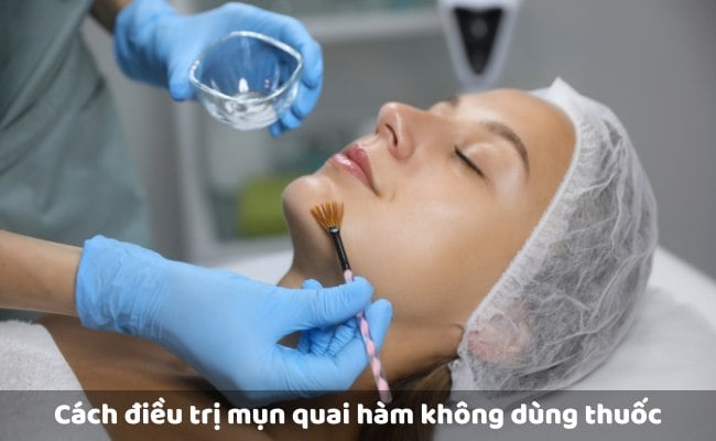 Cách điều trị mụn quai hàm không dùng thuốc