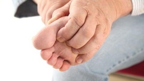 Bài thuốc nam trị nấm da chân