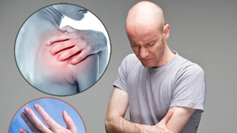 Bài thuốc hay chữa bệnh nhược cơ