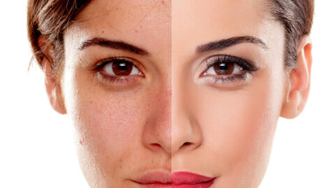 Thảo dược làm đẹp an toàn - xu hướng mới cho các chị em