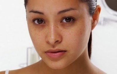 Mẹo chữa chứng thâm quầng mắt hiệu quả