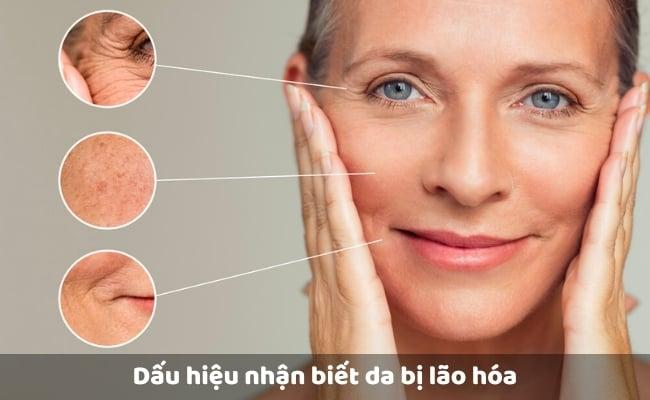 Dấu hiệu nhận biết da bị lão hóa
