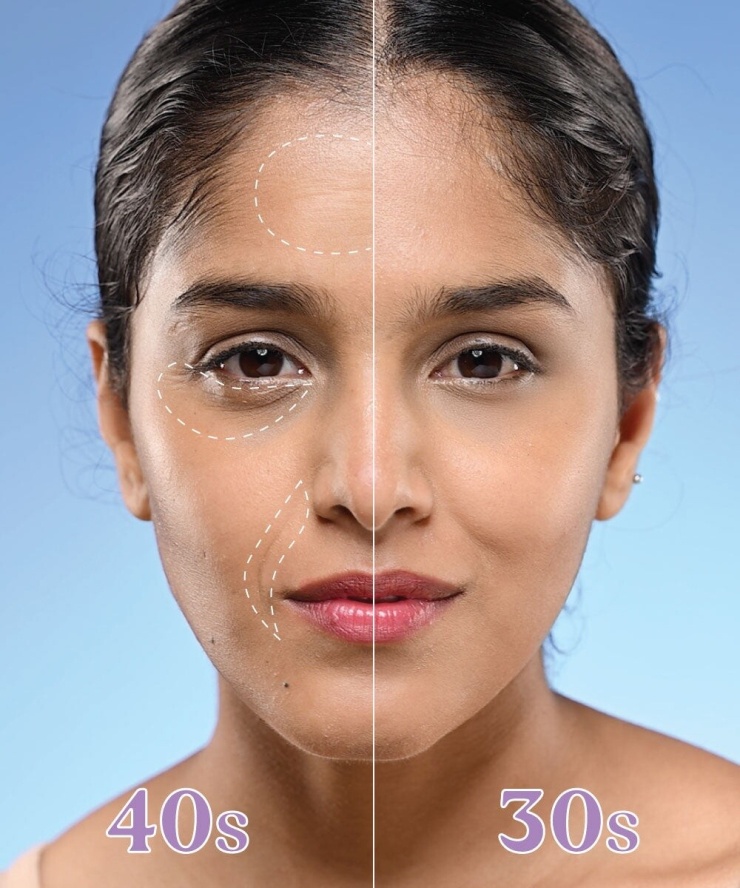 Sự suy giảm collagen, elastin cùng những thay đổi nội tiết khiến làn da ở tuổi 40 dễ chảy xệ, nhăn và mất độ căng mịn hơn so với tuổi 30. Ảnh: Vilvah Sote